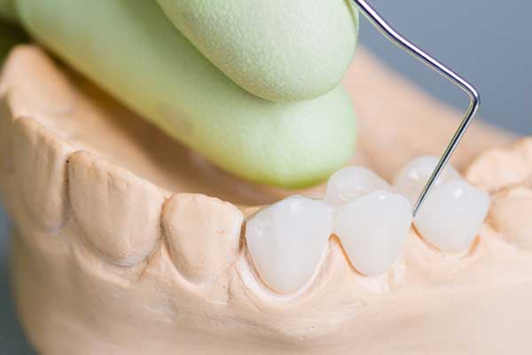 Tooth shade guide being held up to teeth