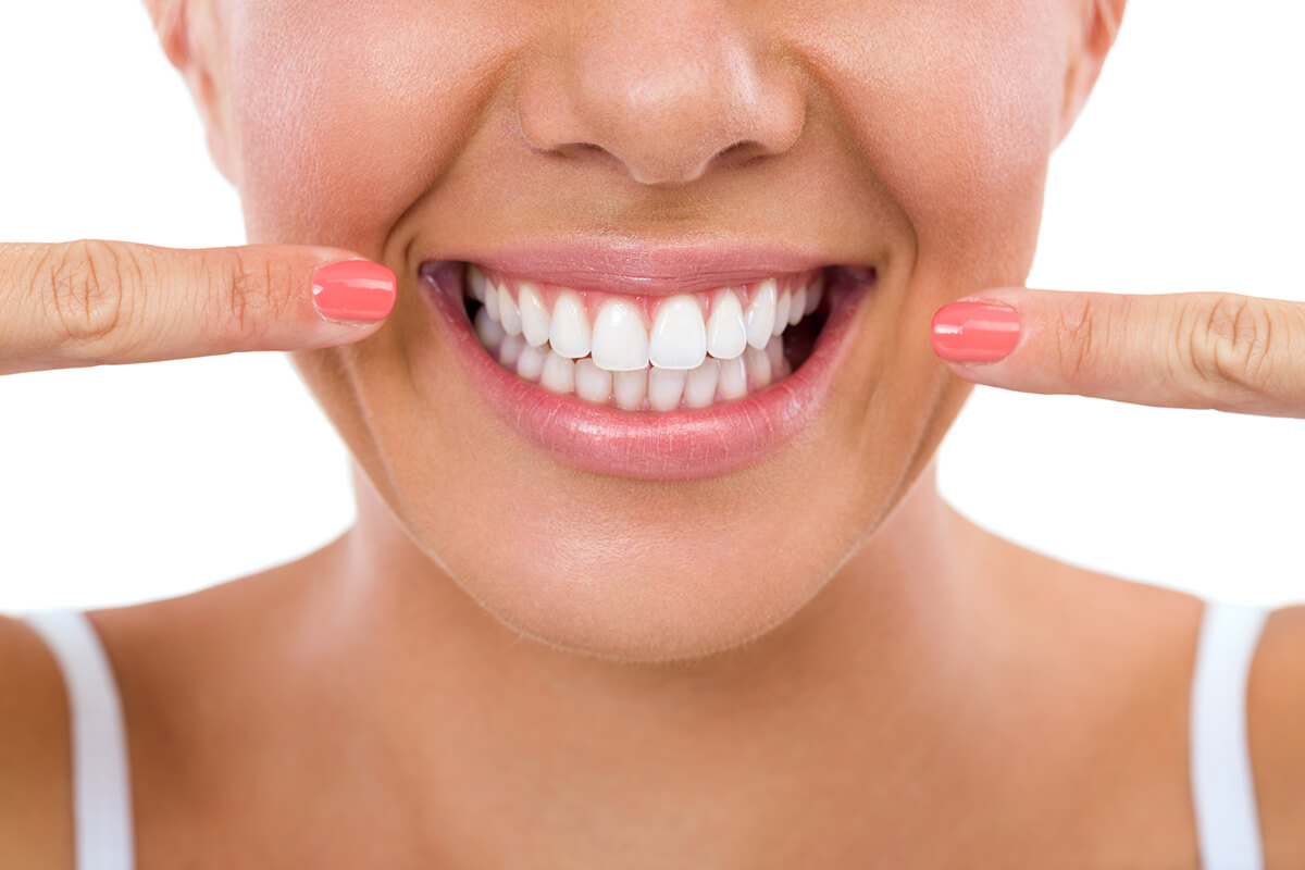 Cost of Professional Teeth Whitening in Lady's Island, SC