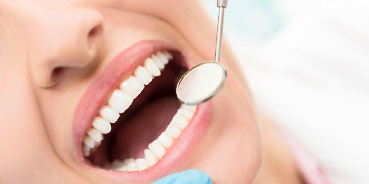 Closeup of Teeth with Dental Mirror